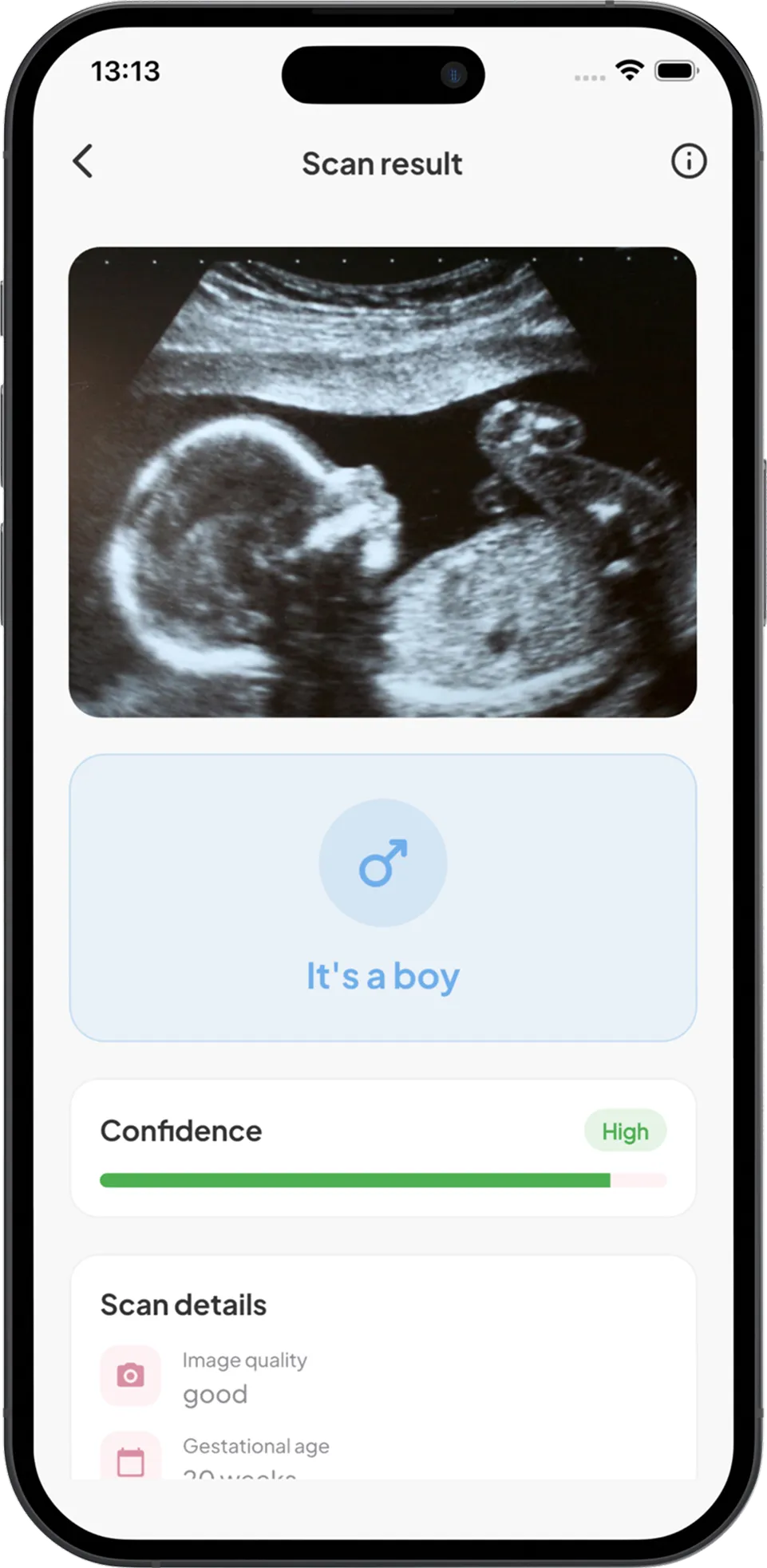 Baby Gender Scanner: Nubbi screenshot